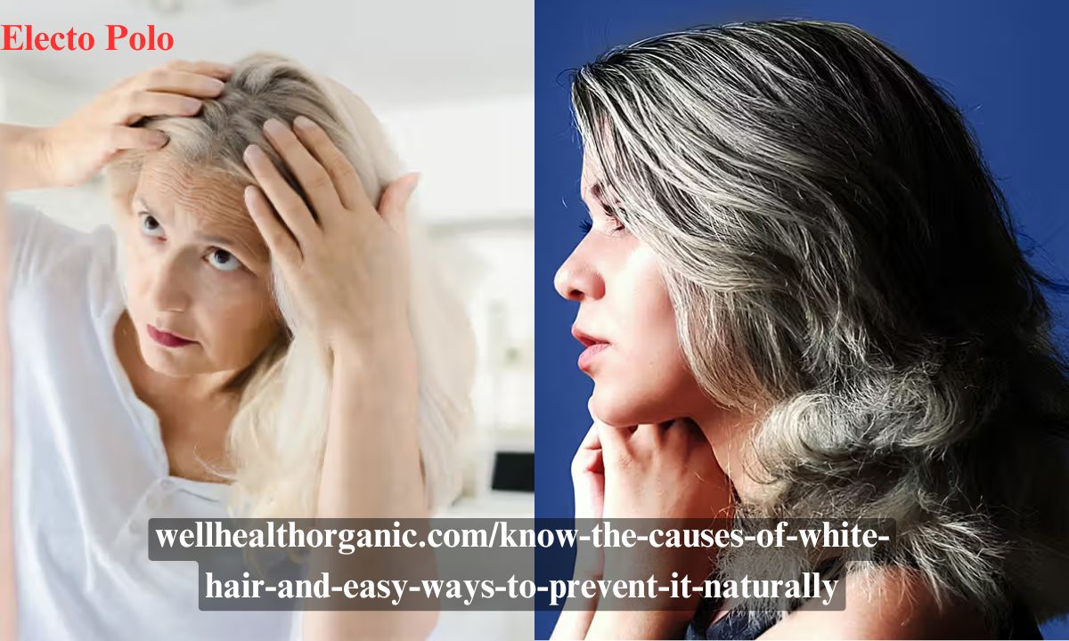 wellhealthorganic.com/know-the-causes-of-white-hair-and-easy-ways-to-prevent-it-naturally