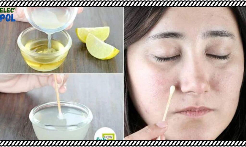 How to Use Lemon Juice to Remove Dark Spots Safely?